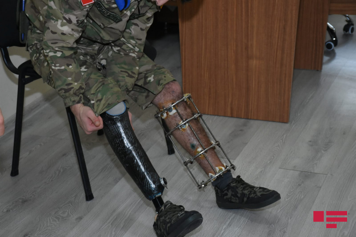 Vətən müharibəsindən sonra 460 şəxs müasir protezlərlə təmin olunub